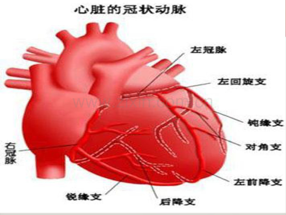 急性前壁心肌梗死护理查房李霞.pdf_第3页