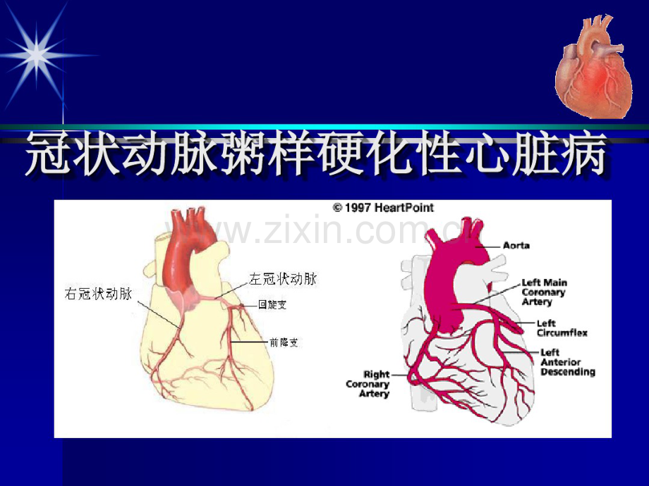 冠状动脉粥样硬化性心脏病(20190829210240).pdf_第1页