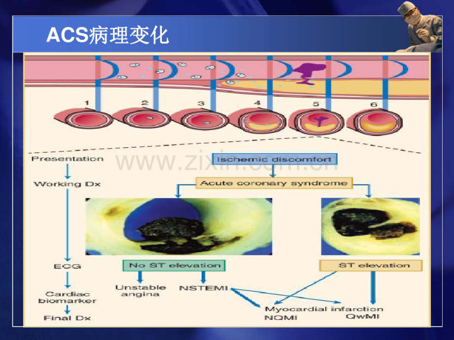 急性冠脉综合征的介入治疗(20190827193114).pdf_第2页