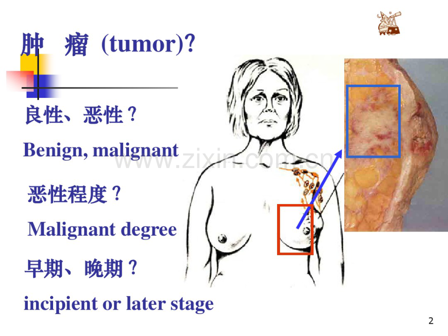 肿瘤3-1(20190829203532).pdf_第2页