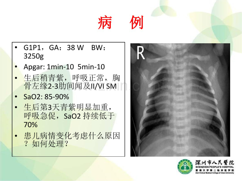 2017新生儿青紫的诊疗思路.pdf_第2页