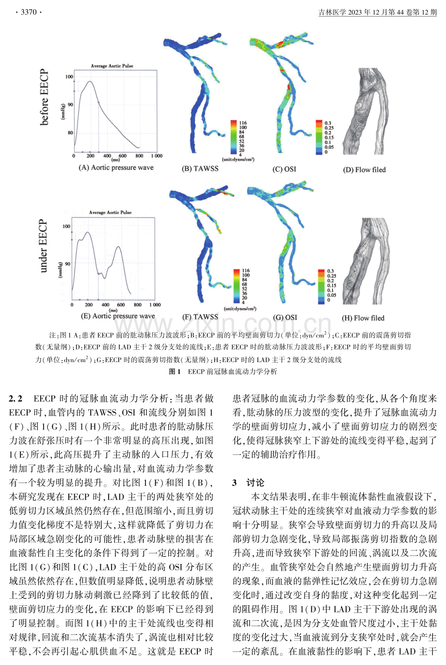 基于非牛顿流体的体外反搏下冠状动脉血流动力学研究 (1).pdf_第3页