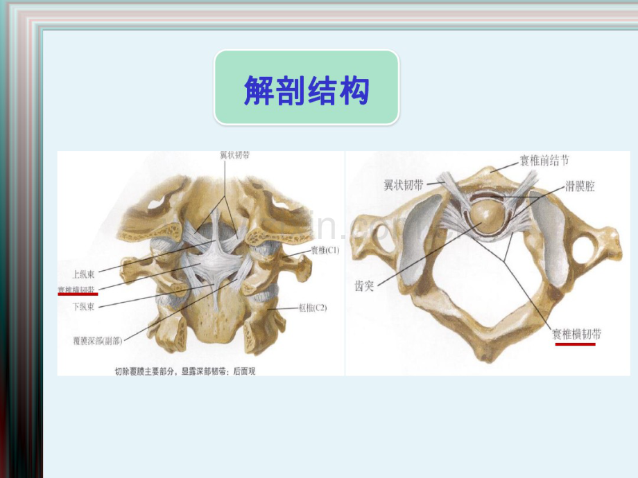 寰椎骨折.pdf_第3页