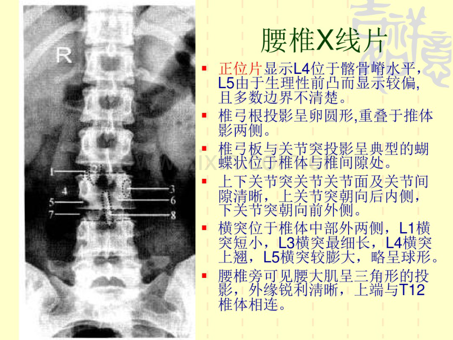 腰椎阅片.pdf_第2页