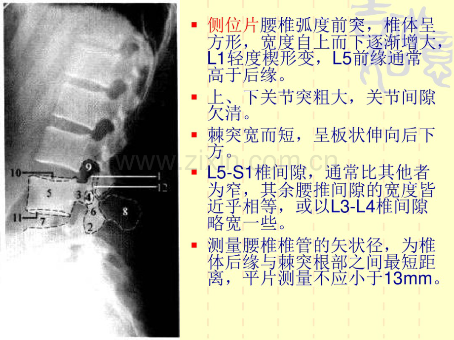 腰椎阅片.pdf_第3页