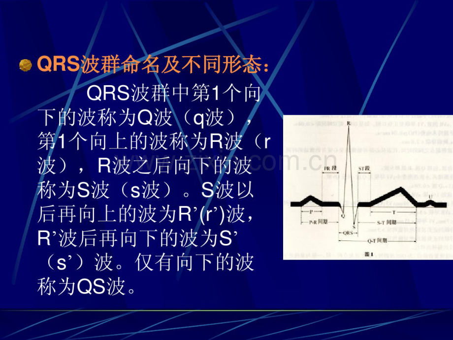 常见心律失常.pdf_第3页