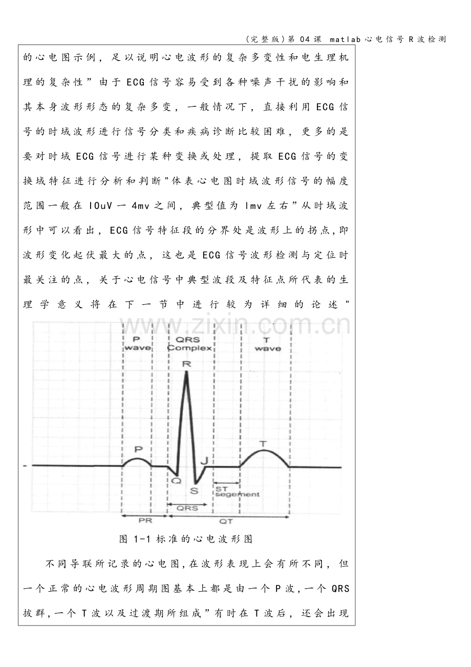 第04课-matlab心电信号R波检测.doc_第2页