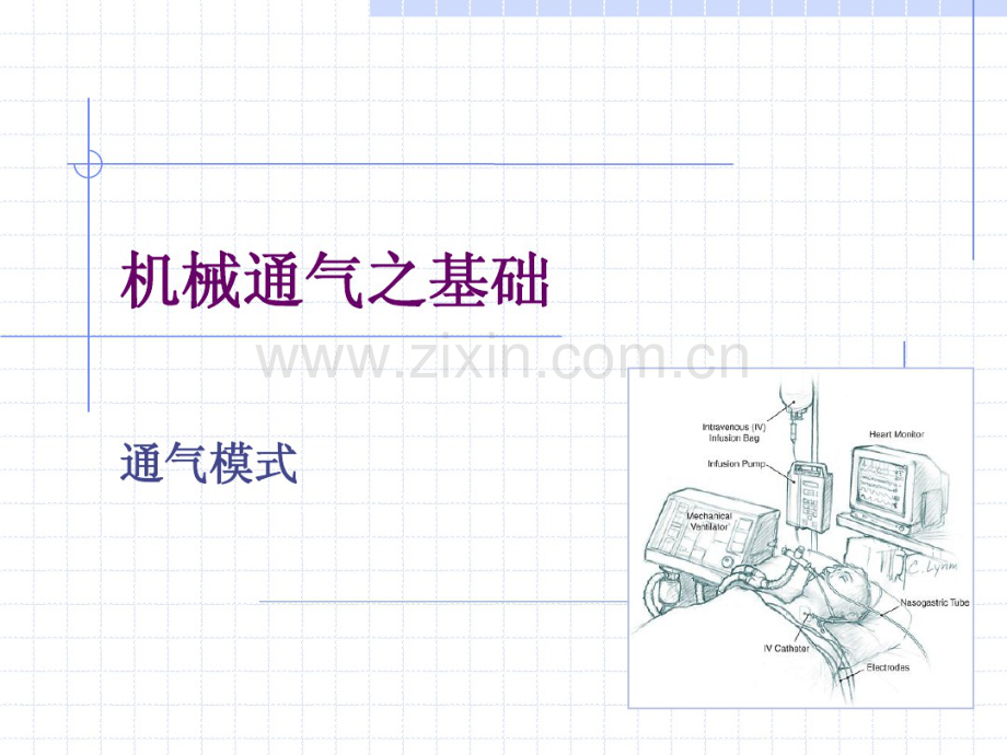 呼吸机模式.pdf_第1页