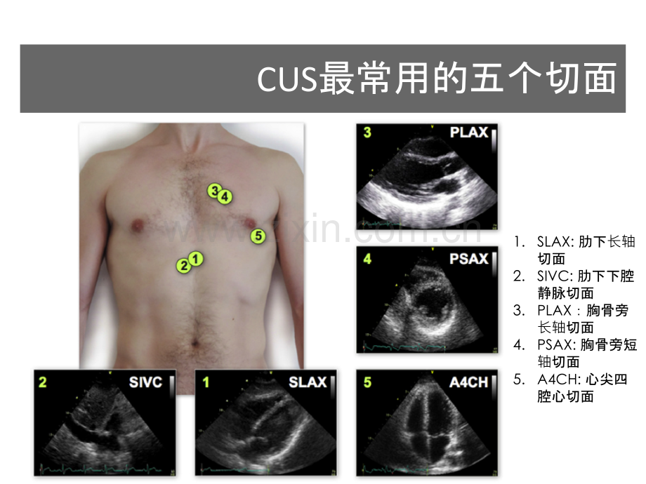 PPT医学课件血流动力学监测与心脏超声讲义.ppt_第1页