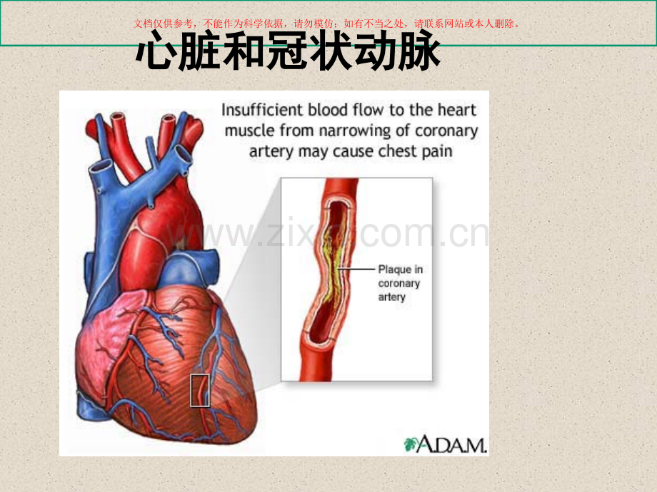 冠心病及其防治课件.ppt_第3页