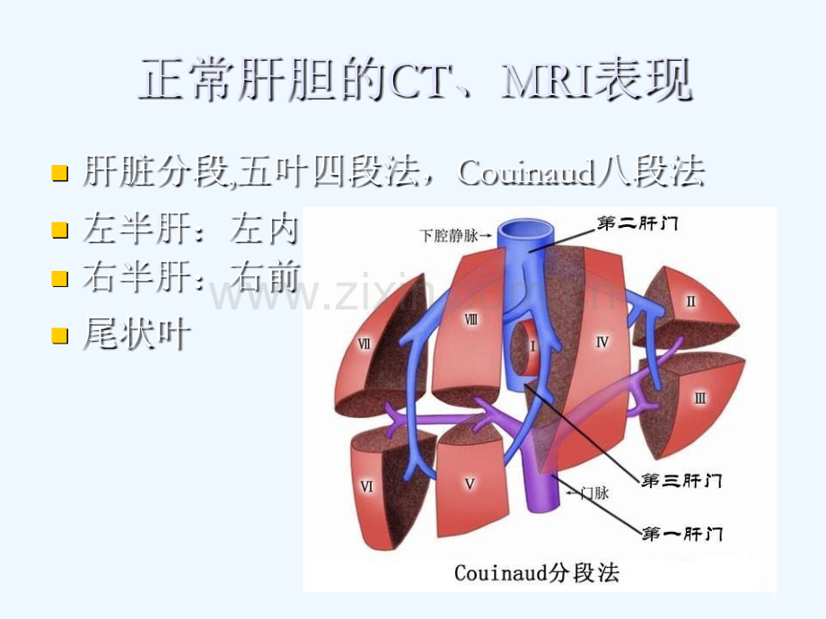 肝脏常见原发肿瘤CTMRI表现.ppt_第3页