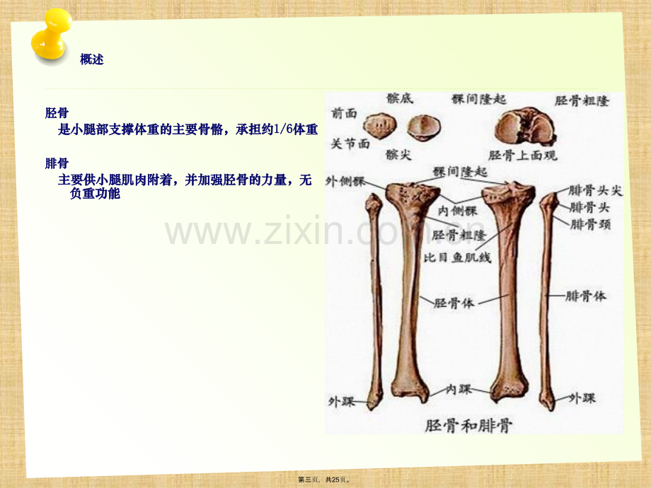 胫腓骨骨折的护理.pptx_第3页