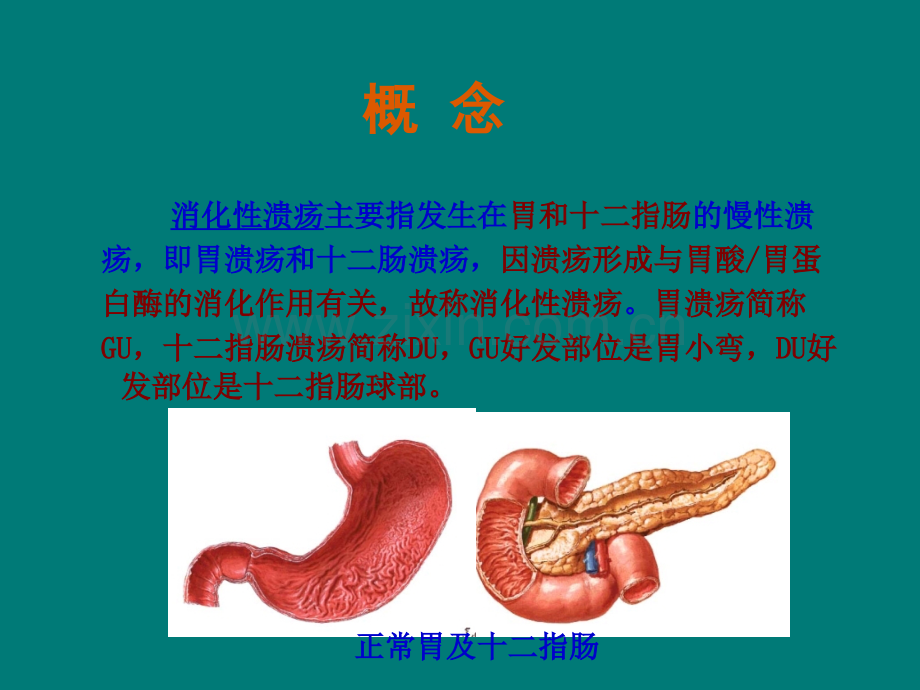 内科护理学-消化性溃疡病人护理.ppt_第3页