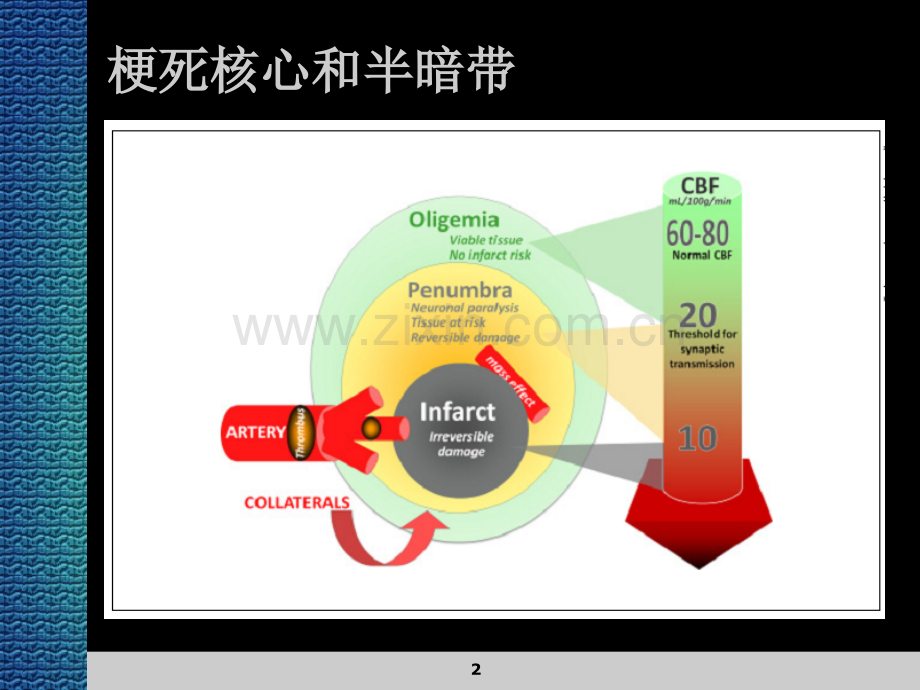 急性缺血性卒中的灌注影像学.ppt_第2页