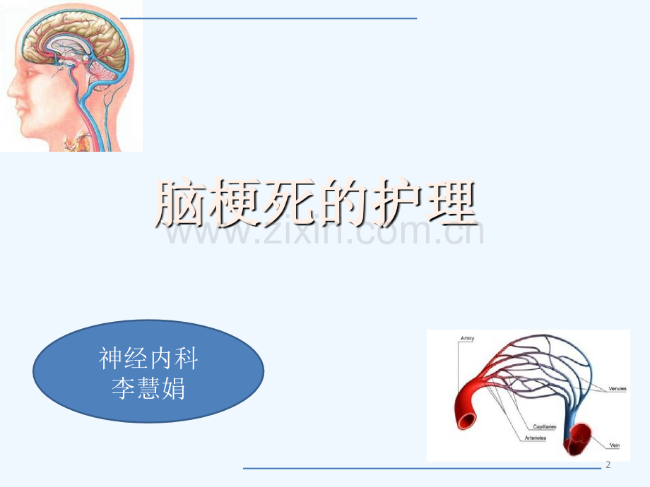 脑梗死的护理内容.ppt_第2页