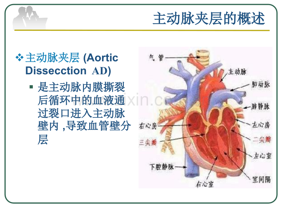 主动脉夹层的医疗护理PPT优质课件.ppt_第3页