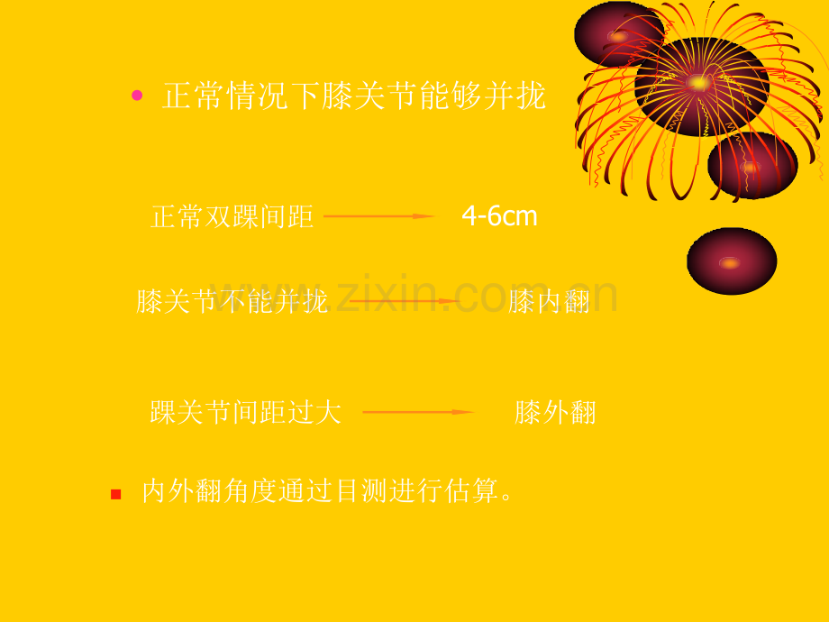 膝关节物理检查.ppt_第3页