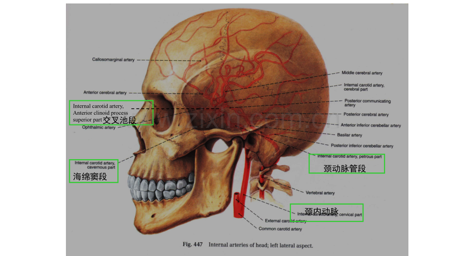 PPT医学课件脑动脉解剖及临床脉络膜前动脉讲义.ppt_第3页