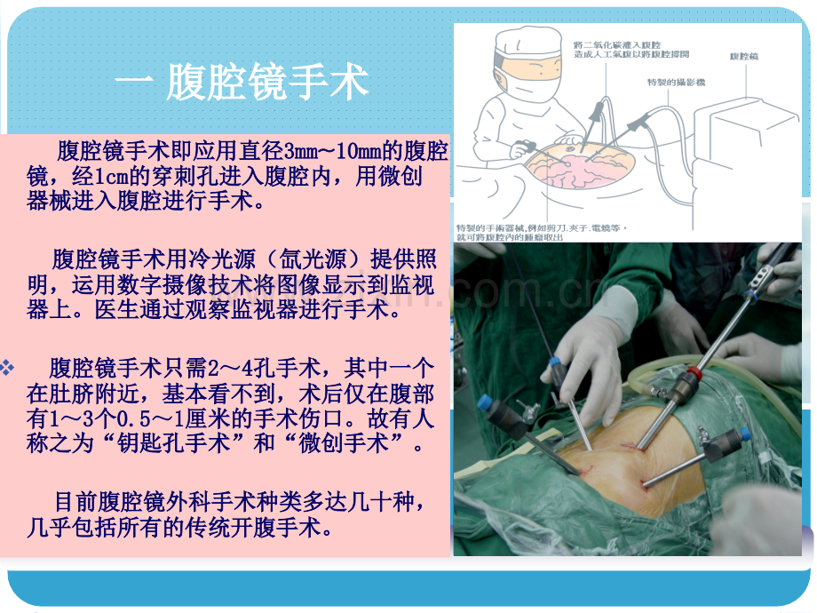 PPT医学课件腹腔镜的操作标准讲义.ppt_第2页