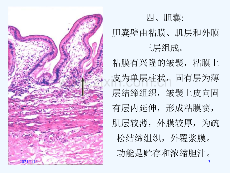 病理学教学及实验(附大量图片).ppt_第3页