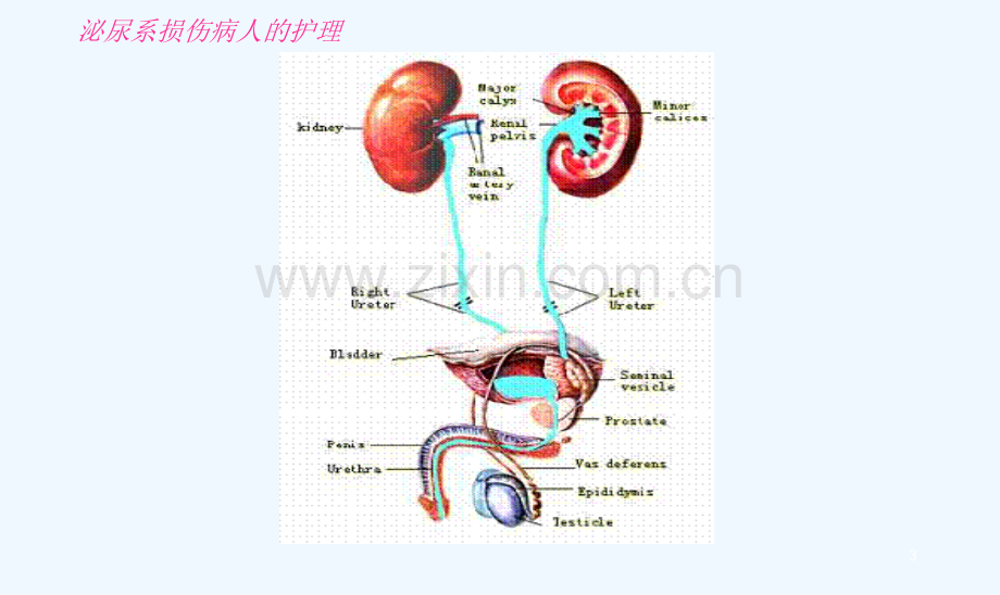 泌尿系统损伤病人护理.ppt_第3页