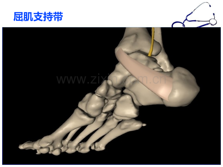 足底神经的解剖.ppt_第3页