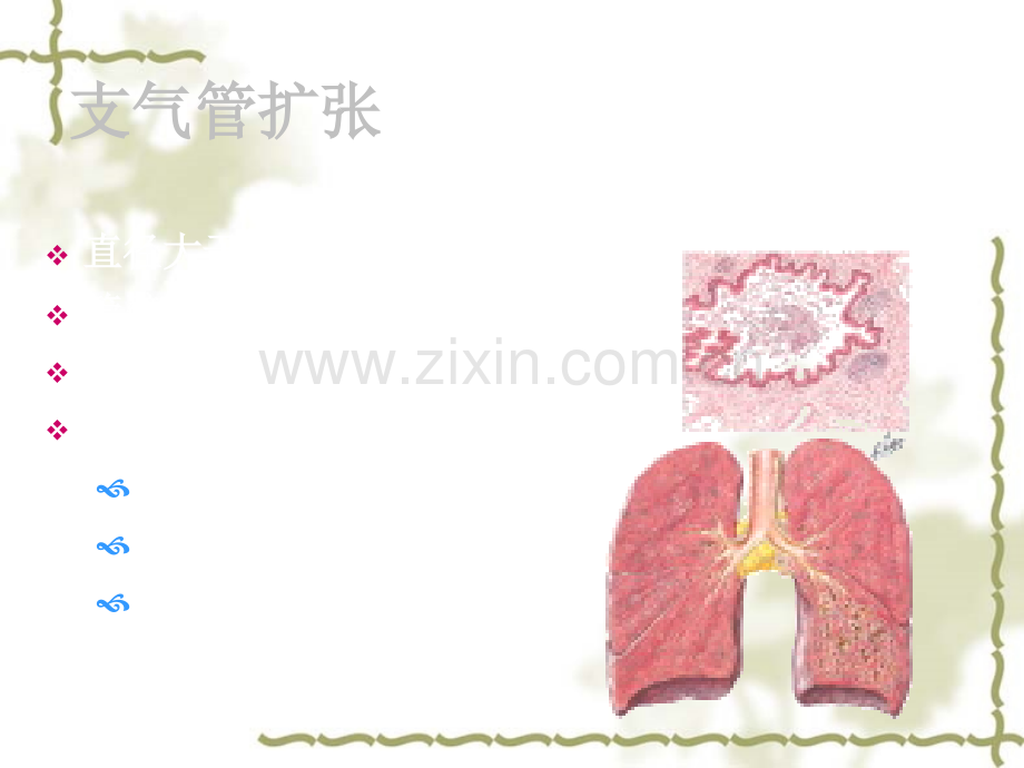 内科护理学-呼吸系统-支气管扩张.ppt_第3页