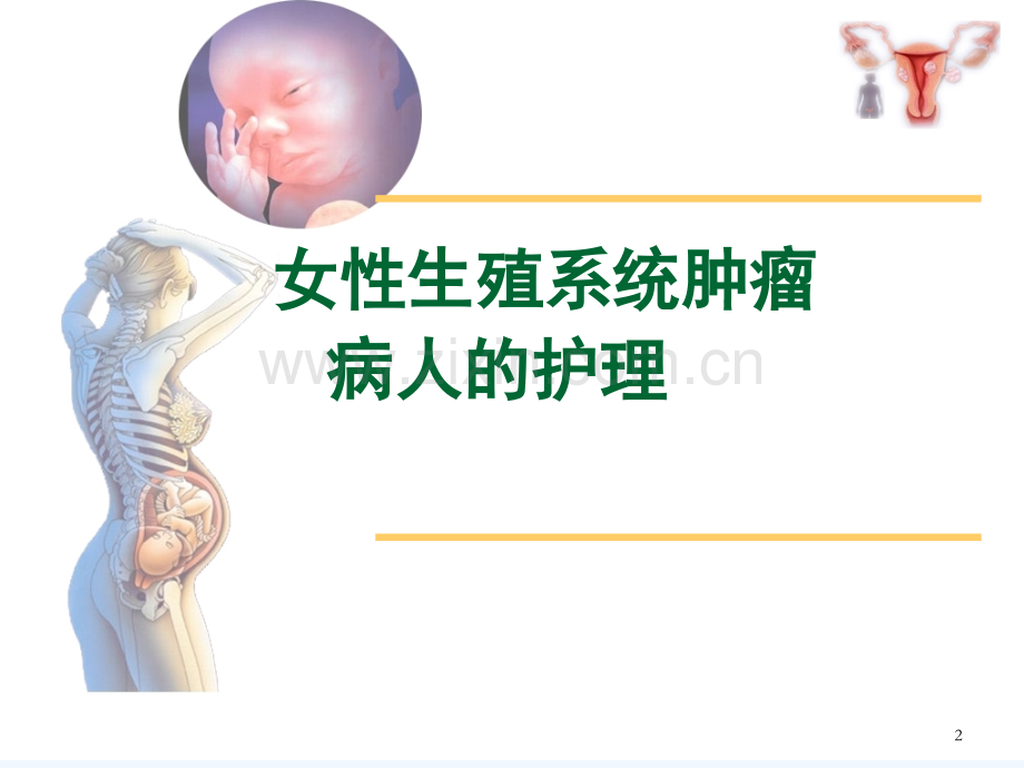 女性生殖系统肿瘤护理培训.ppt_第2页