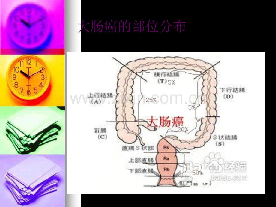 大肠癌防治及康复.ppt_第3页