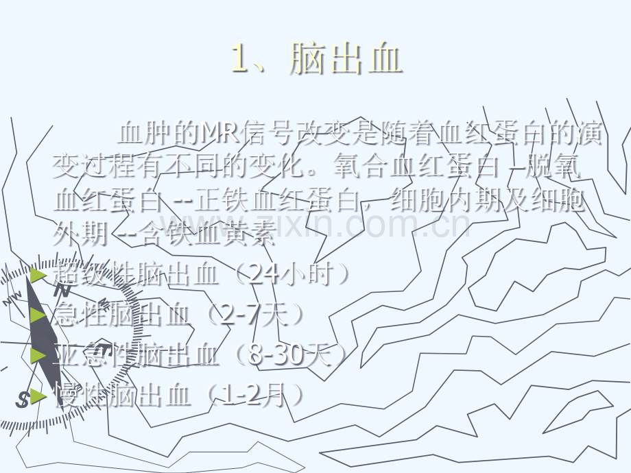 颅脑血管性病变影像学诊断.ppt_第3页