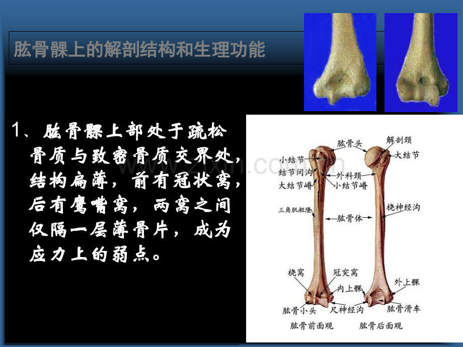 肱骨髁上骨折自制.ppt_第3页