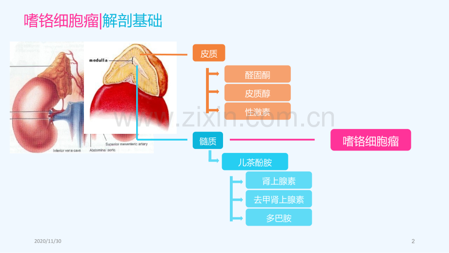 嗜铬细胞瘤影像诊断.ppt_第2页