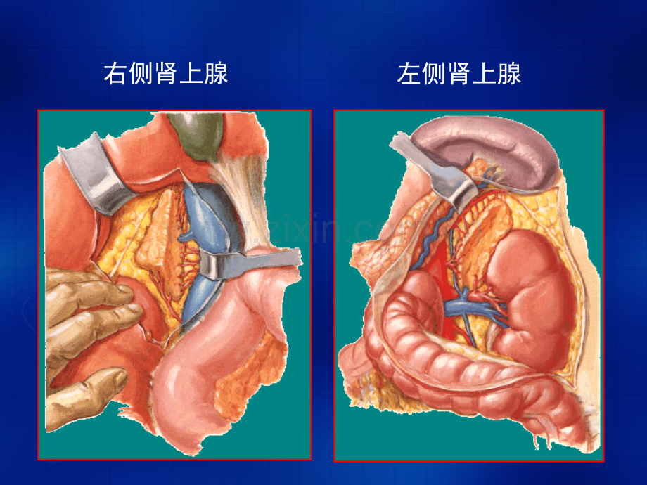 PPT医学课件肾上腺肿瘤及瘤样病变的影像诊断讲义.ppt_第3页