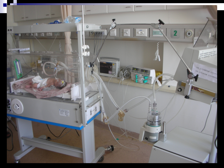 新生儿呼吸机临床应用.ppt_第2页