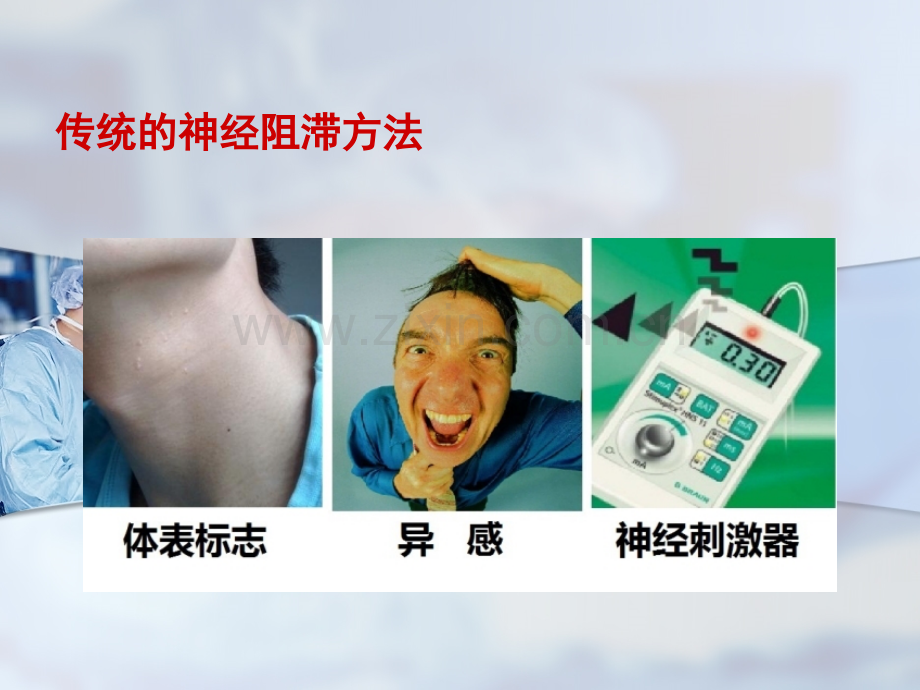 医学B超引导下神经阻滞一例ppt培训课件.ppt_第2页