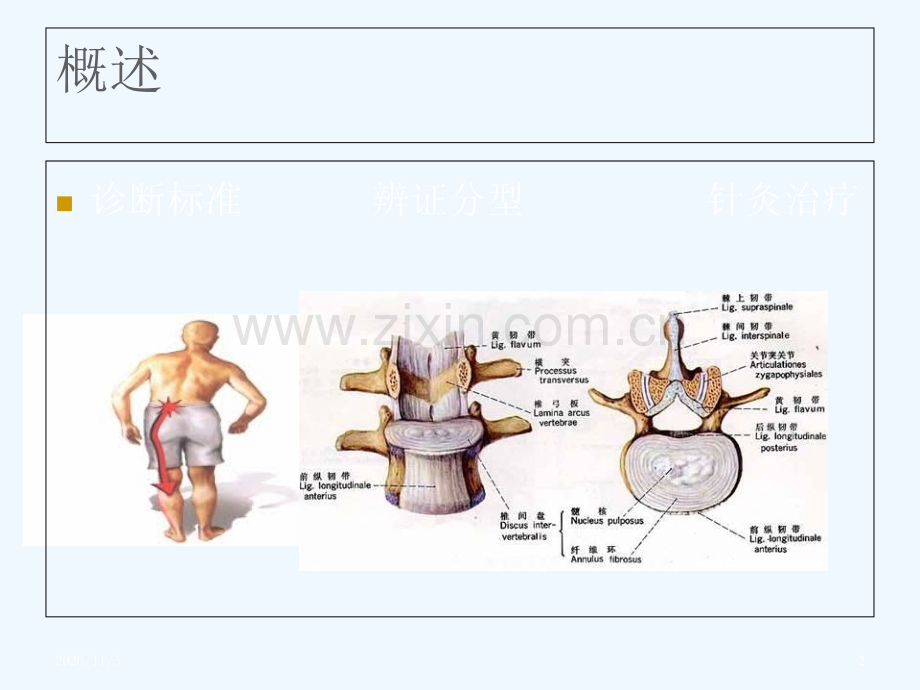 腰椎间盘突出症的针灸治疗.ppt_第2页