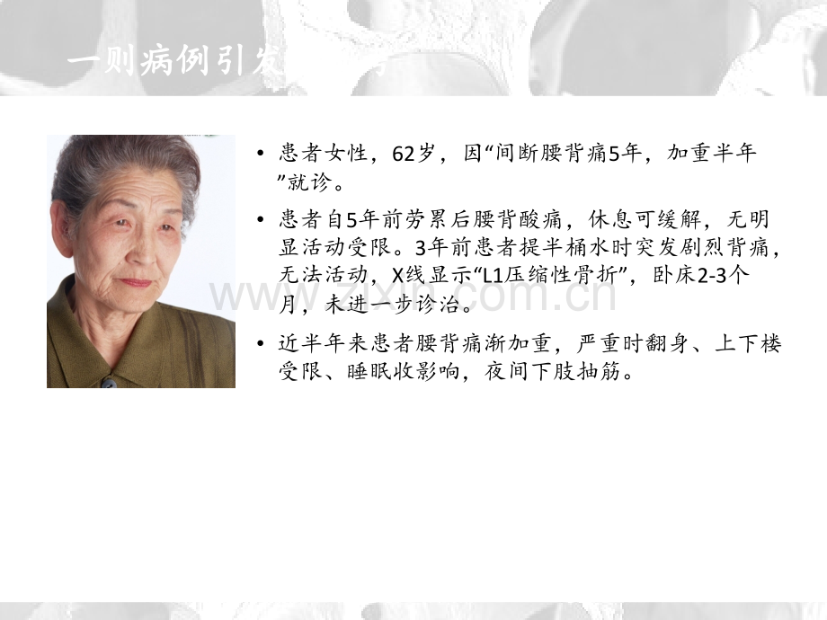 老年骨质疏松症的社区防治.ppt_第2页