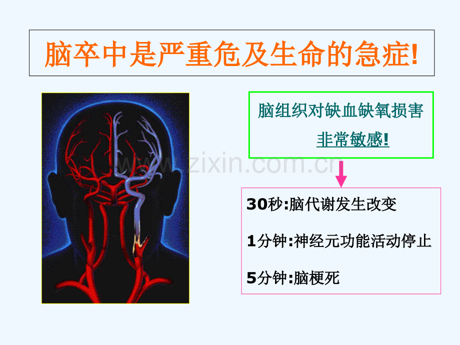 急性脑梗死静脉溶栓的护理查房.ppt_第3页