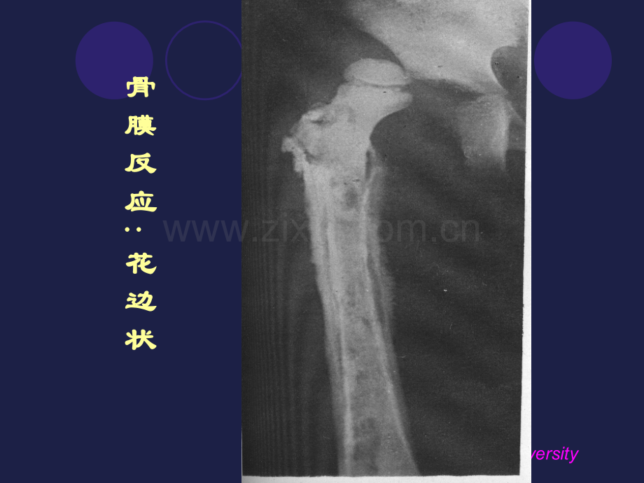 上肢骨影像解剖讲义.ppt_第2页