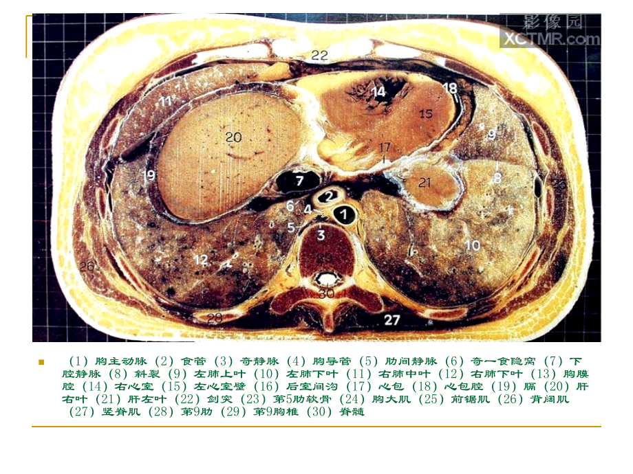 医学人体断层解剖图谱腹腔PPT培训课件.ppt_第3页