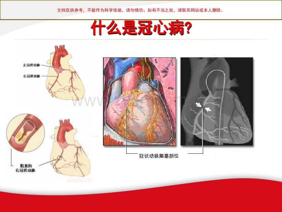 冬季冠心病防治患者教育课件.ppt_第1页