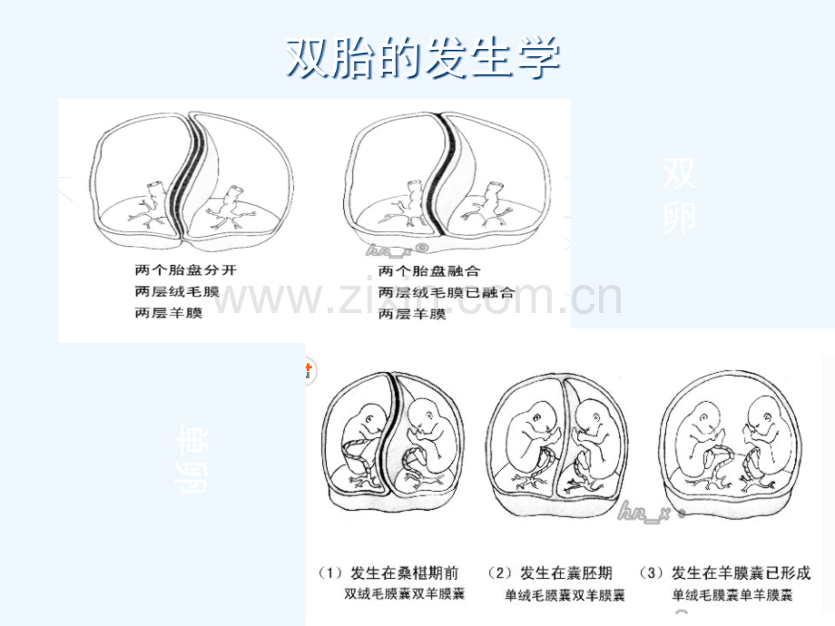 双胎妊娠管理流程.pptx_第3页