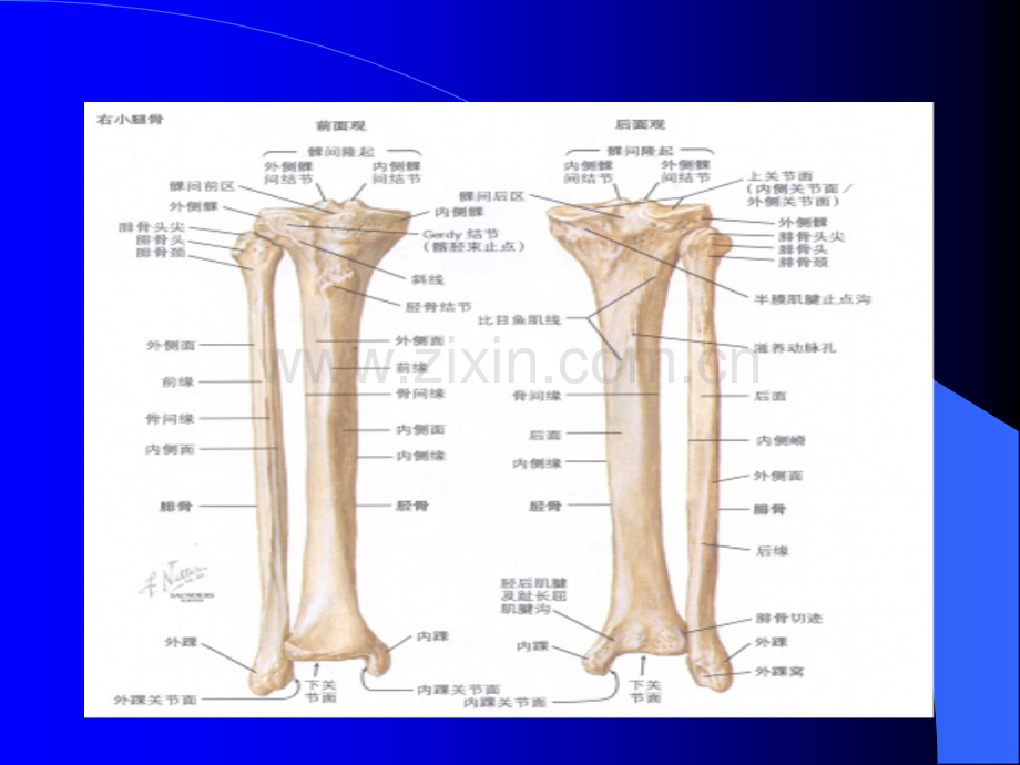 PPT医学课件胫腓骨骨折医学知识专题讲座讲义.ppt_第3页