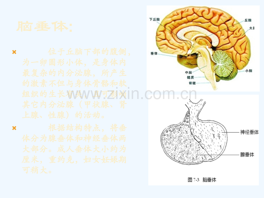 脑垂体瘤的治疗和护理.ppt_第3页