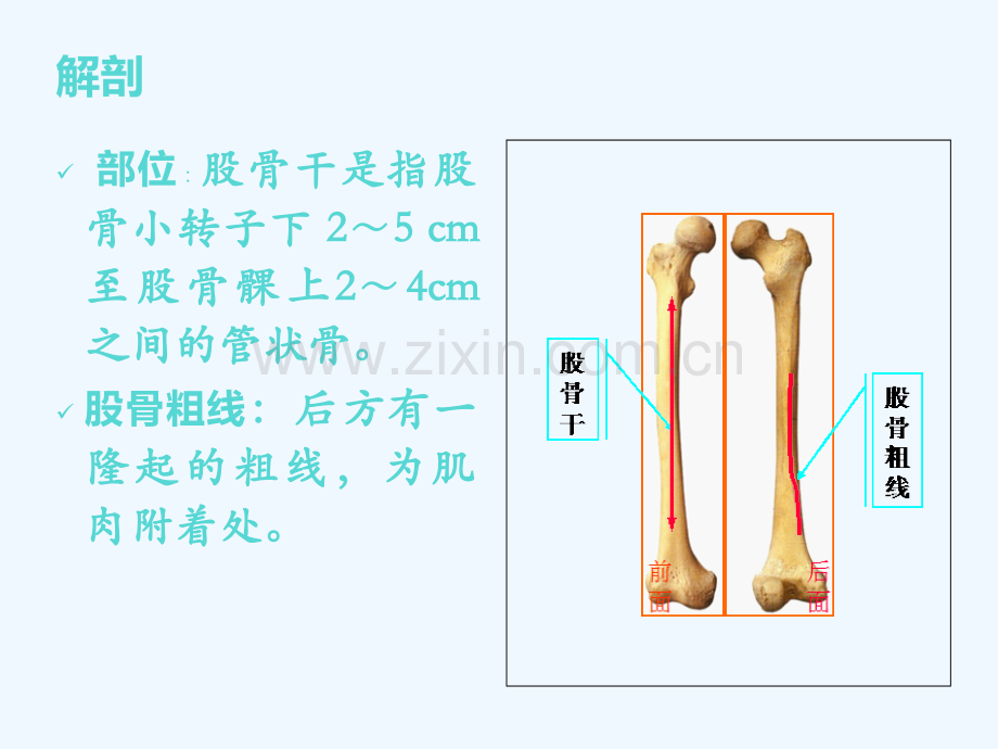 悬吊牵引治疗小儿股骨干骨折.ppt_第3页