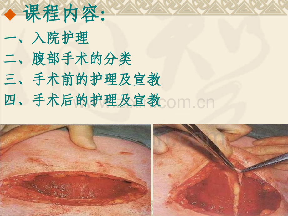 妇科腹部手术护理及宣讲.ppt_第3页