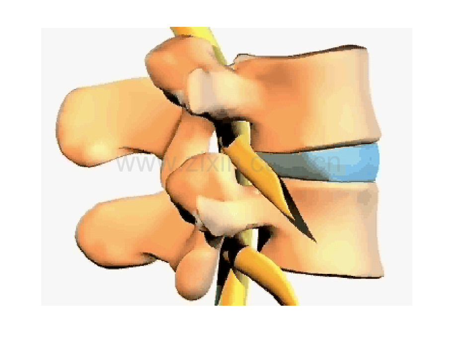 PPT医学课件腰椎间盘突出症讲义.ppt_第2页