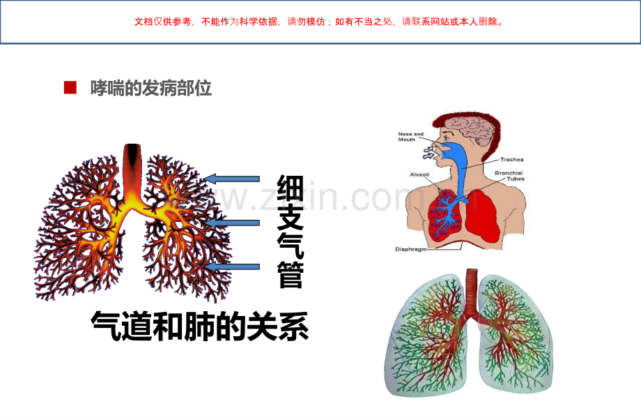 儿童哮喘防治课件.ppt_第2页