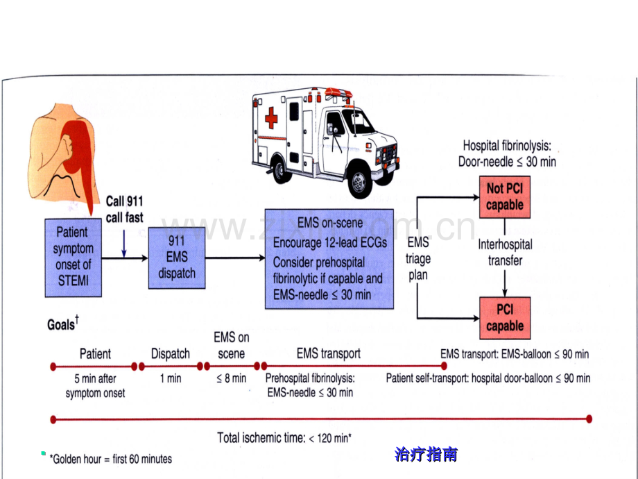 急性心肌梗死治疗.ppt_第2页