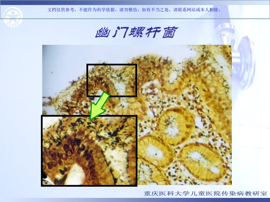 儿童消化性溃疡病主题讲座课件.ppt_第3页